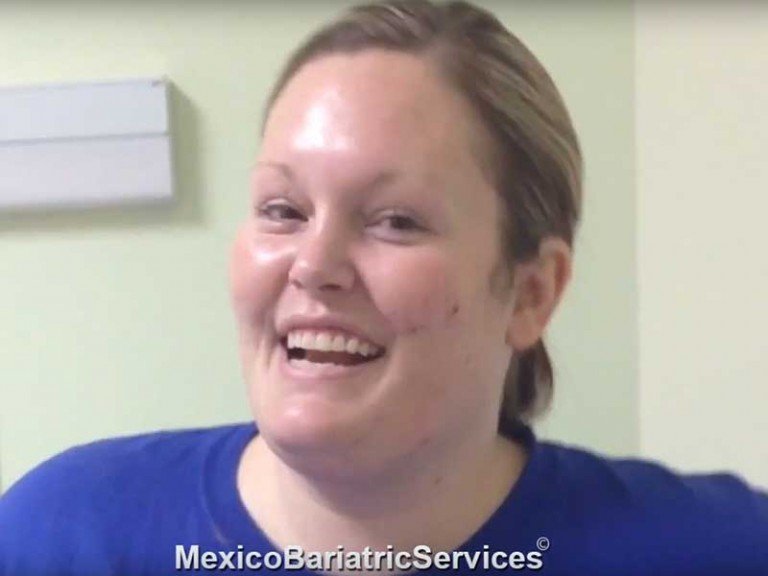 Gastric Sleeve In Tijuana - Client Experience