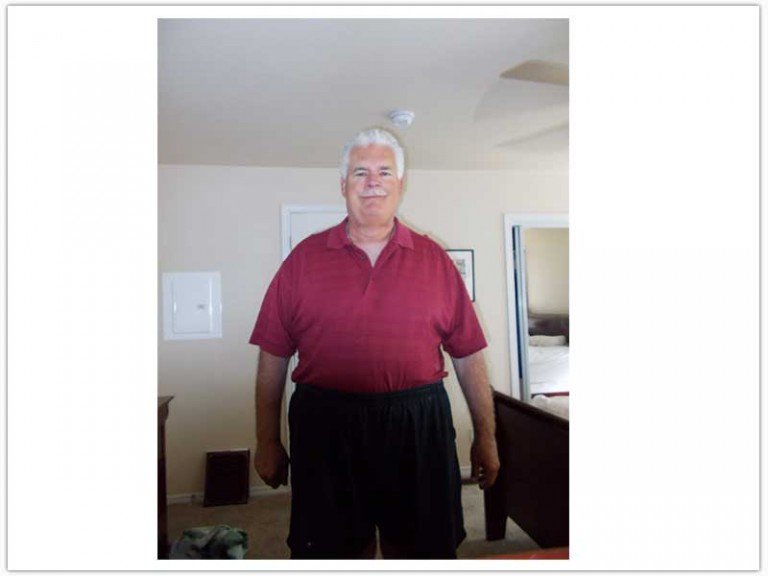 Gastric Sleeve in Mexico - Testimonial