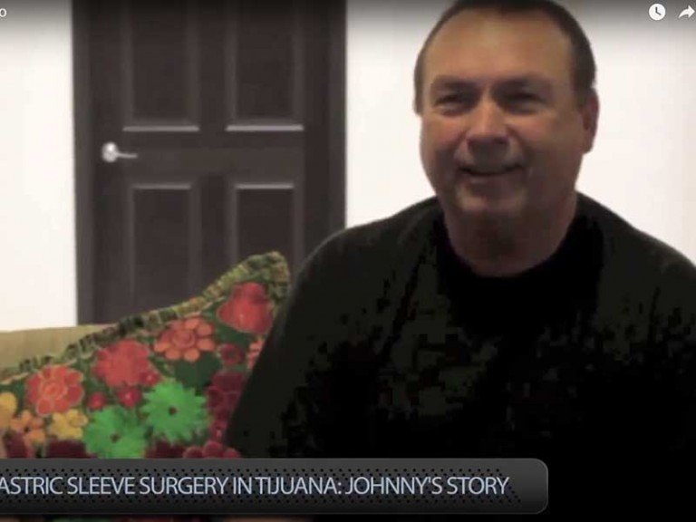 Sleeve Surgery in Tijuana – Johnny’s Story