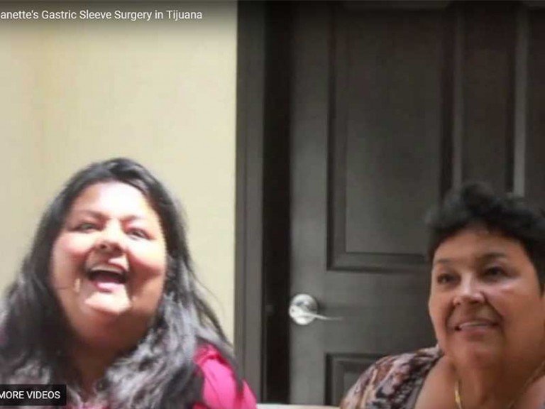 Vertical Sleeve Gastrectomy Testimonial - Tijuana