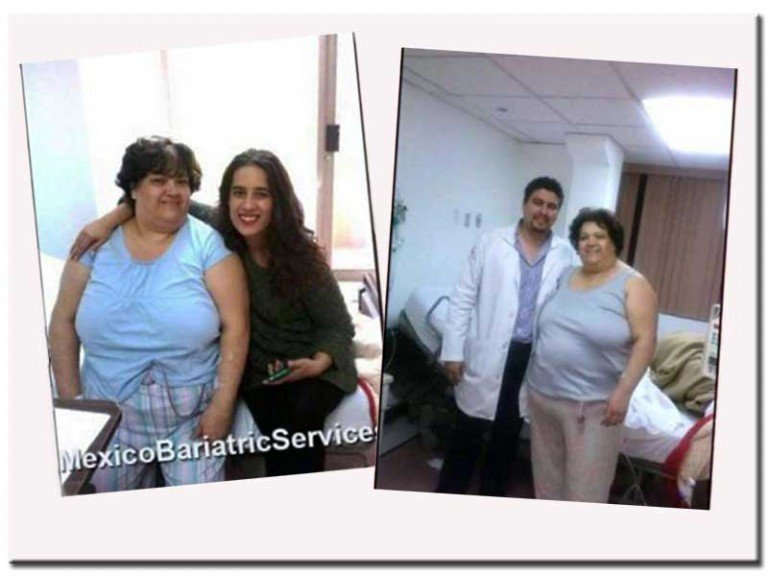 Stomach Sleeve In TJ - Client Testimonial