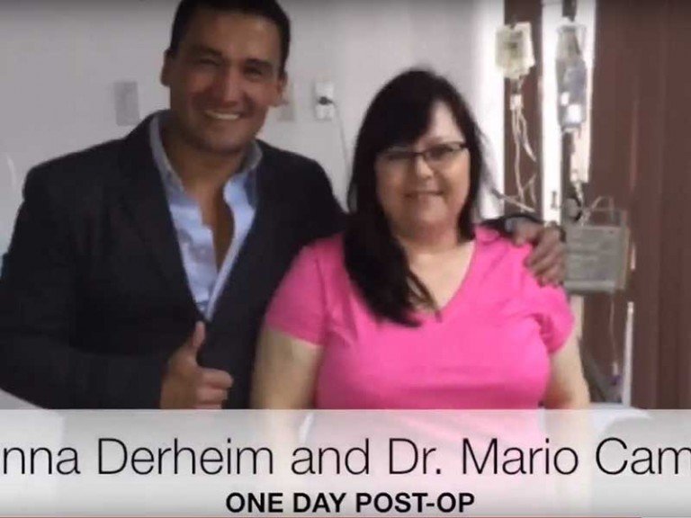 Gastric Sleeve Testimonial Tijuana MX