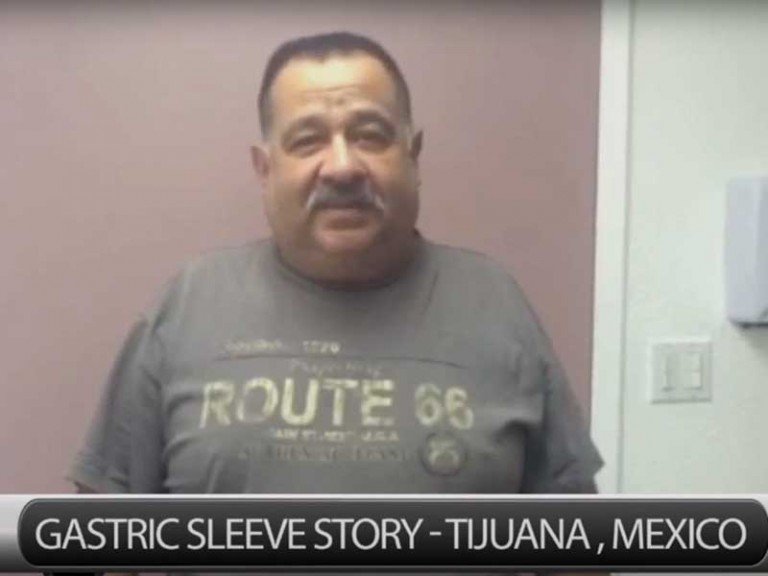 Review Of VSG In Tijuana