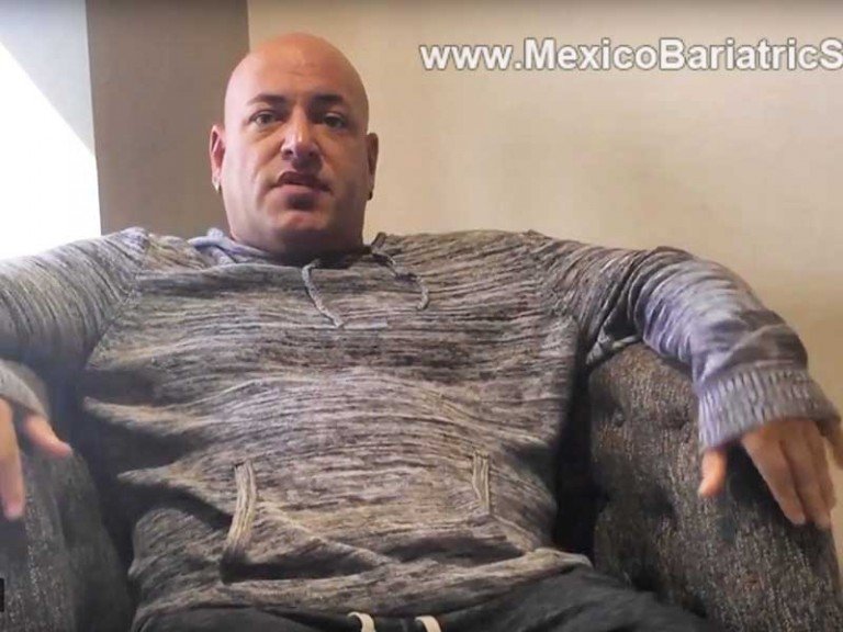 Sleeve Gastrectomy in Tijuana, Mexico Testimonial