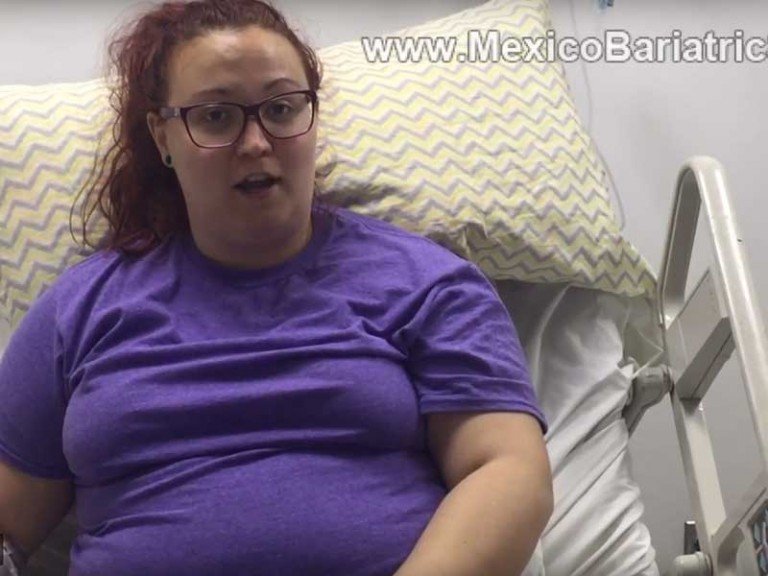 Dr. Green's Review - Gastric Sleeve in Tijuana