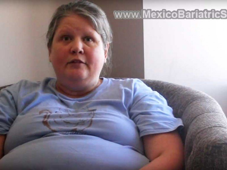 Testimonial on Gastric Sleeve Mexico