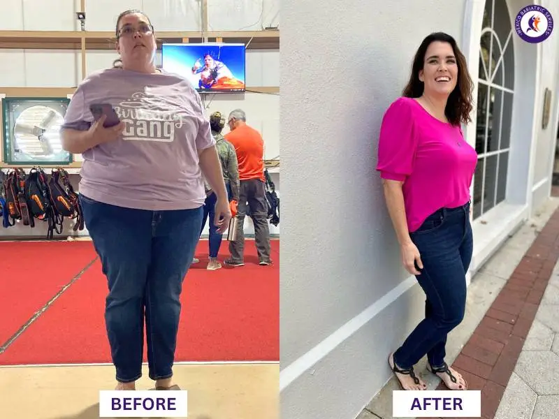 Stephanie Meyers Donn lost 325 lbs with gastric sleeve surgery in Cancun by Dr. Hector Perez
