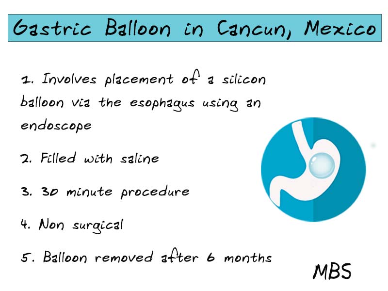 Gastric Balloon Cancun - Mexico