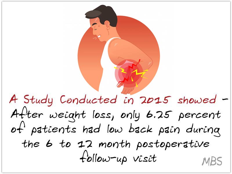 Back Pain After Weight Loss Surgery