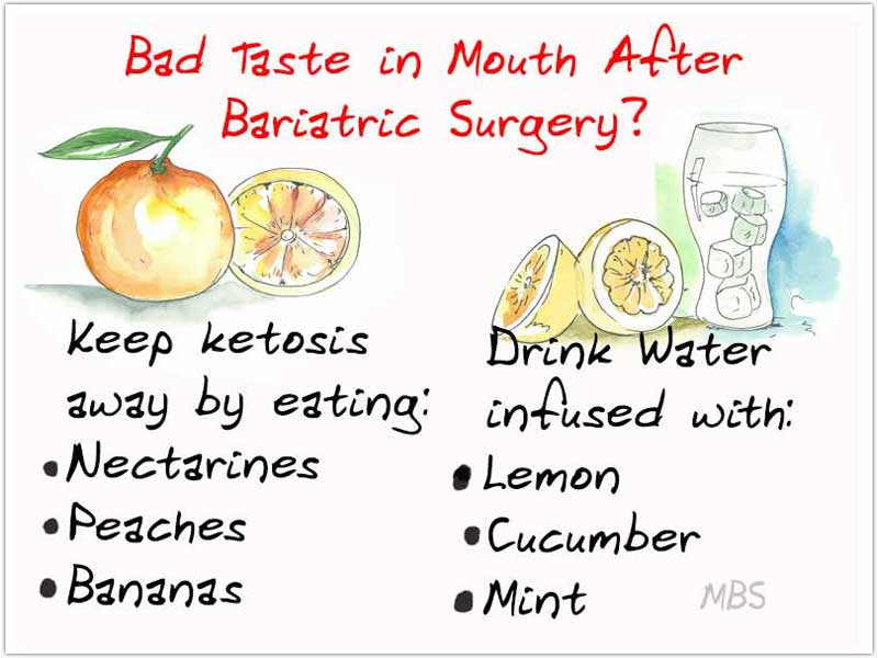 Metallic Taste in Mouth Post Bariatric Surgery