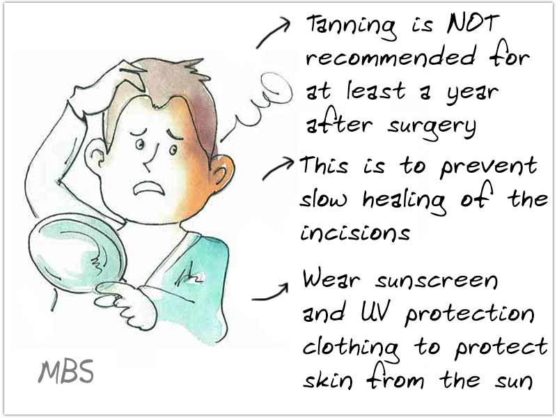 Tanning Bariatric Surgery