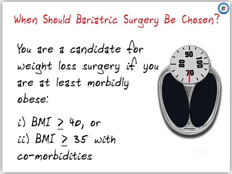 Choosing Weight Loss Surgery Choosing Weight Loss Surgery