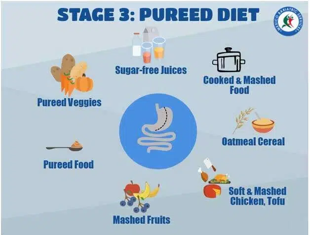 Gastric Sleeve Diet Stage 3