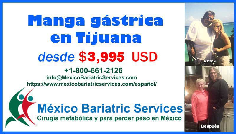 Manga Gastrica En Tijuana 3 995