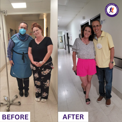  Weight Loss Surgery in Cancun | Before and After