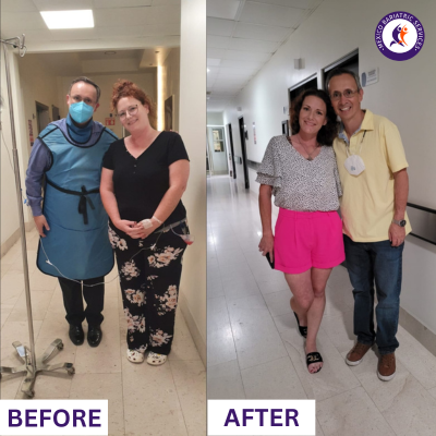 Weight Loss Surgery in Cancun | Before and After Weight Loss Surgery in Cancun | Before and After