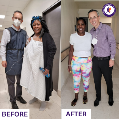 Weight Loss Surgery in Cancun | Before and After Weight Loss Surgery in Cancun | Before and After