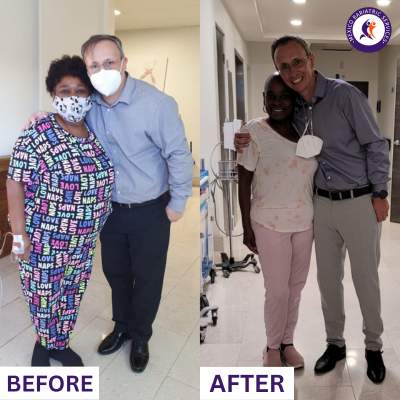 Before & After Gastric Balloon in Mexico Before & After Gastric Balloon in Mexico