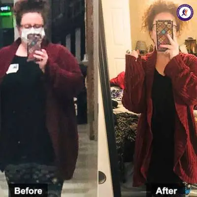 Janelle Woodburn, Gastric sleeve in Tijuana Before after Gastric sleeve in Tijuana, Before after, Janelle Woodburn lost 90 lbs in 17 months,