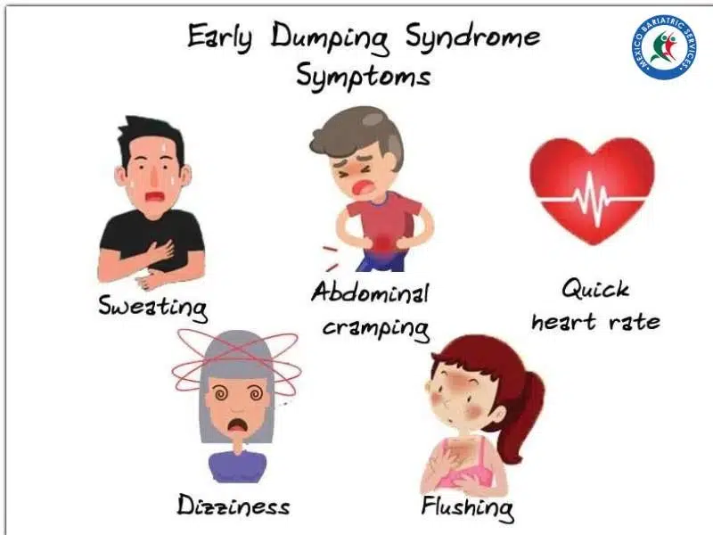 Early Dumping Syndrome Symptoms Bariatric Surgery
