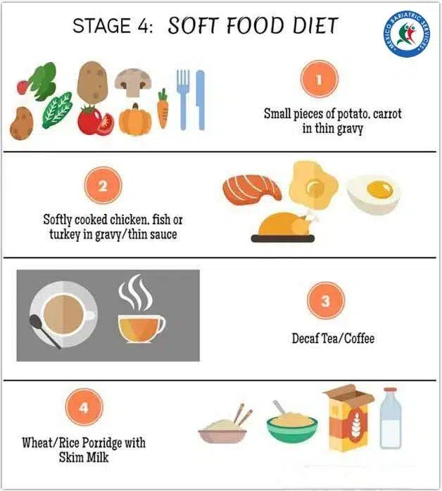 Gastric Sleeve Diet Stage 4