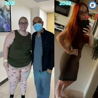 Revision weight loss surgery, Puerto Vallarta Revision weight loss surgery, Puerto Vallarta
