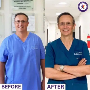 After surgery, Dr. Perez successfully lost 30-40% of excess weight! 
