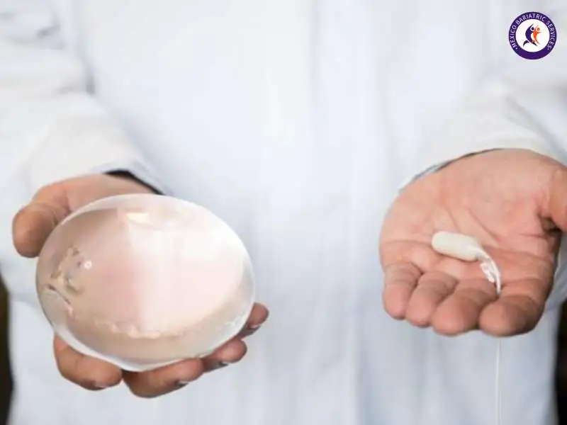 Allurion Gastric Balloon Allurion Gastric Balloon in Mexico